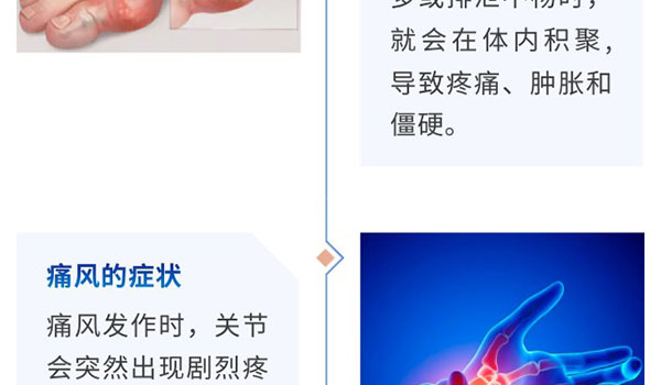“痛” 定思痛，，，，，，相识痛风的真相-新闻资讯-江苏森纳医疗科技有限公司